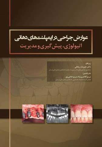 کتاب عوارض جراحی در ایمپلنت های دهانی اتیولوژی، پیشگیری و مدیریت