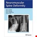  خرید کتاب Neuromuscular Spine Deformity 1st Edition2018 تغییر شکل عضله عصبی عضلانی