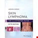  Skin Lymphoma: The Illustrated Guide 2020 راهنمای مصور لنفوم پوستی 