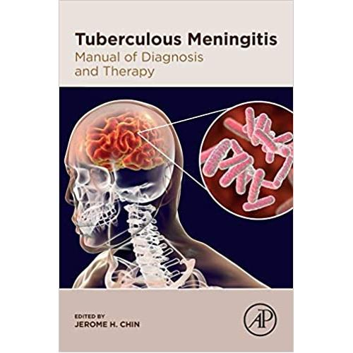 کتاب مننژیت سل راهنمای تشخیص و درمان