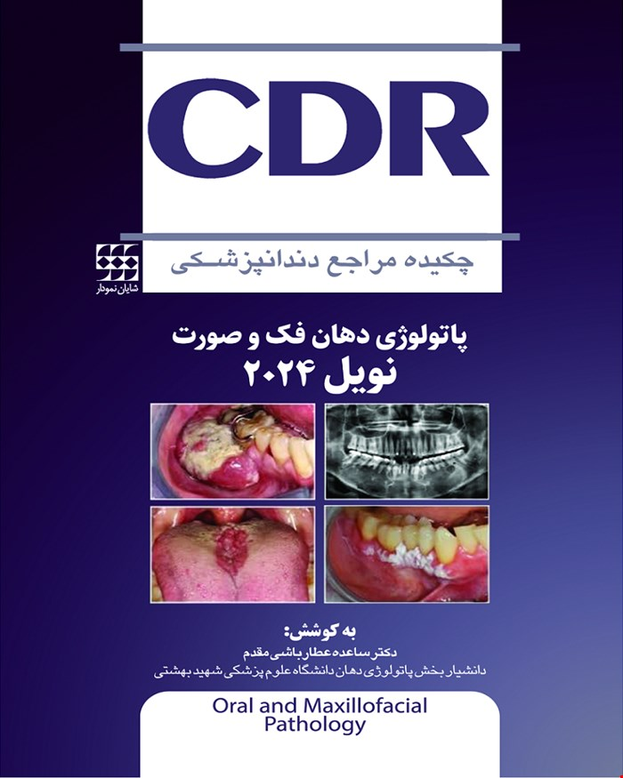کتاب CDR پاتولوژی دهان فک و صورت نویل 2024 چکیده مراجع دندانپزشکی انتشارات شایان نمودار