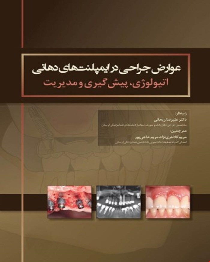 کتاب عوارض جراحی در ایمپلنت های دهانی اتیولوژی، پیشگیری و مدیریت انتشارات رویان پژوه