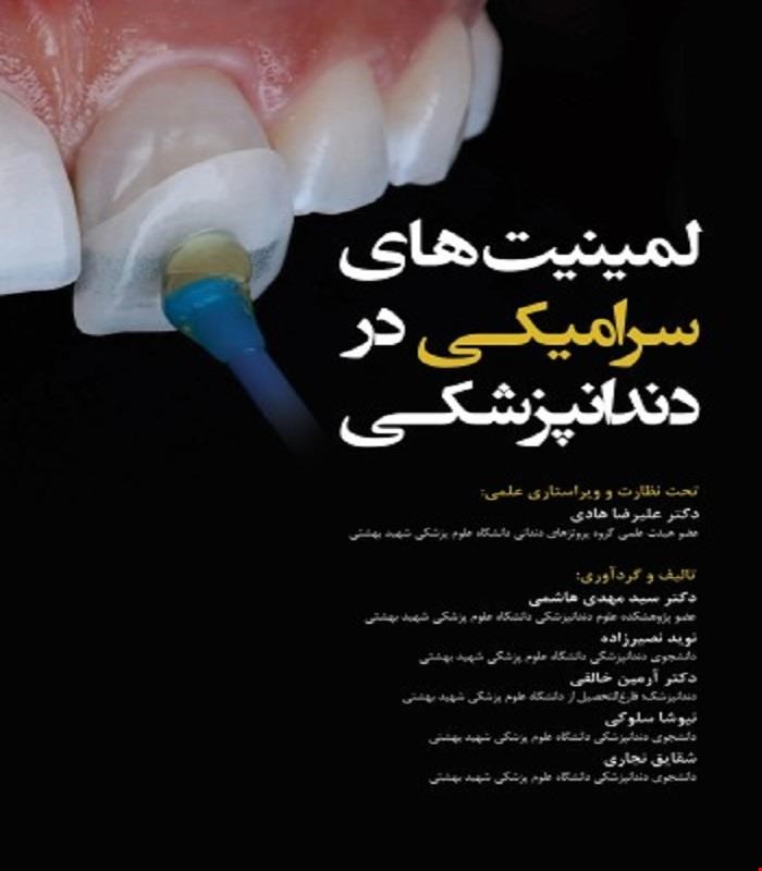 کتاب لمینیت های سرامیکی در دندانپزشکی انتشارات رویان پژوه