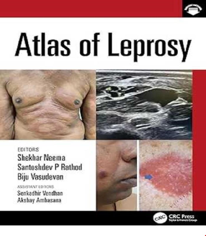 کتاب  Atlas of Leprosy 2025