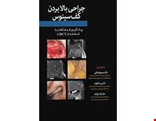 کتاب جراحی بالا بردن کف سینوس انتشارات آرتین طب