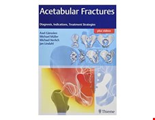 کتاب Acetabular Fractures: Diagnosis, Indications, Treatment Strategies, 1e