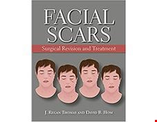 کتاب Facial Scars Surgical Revision and Treatment