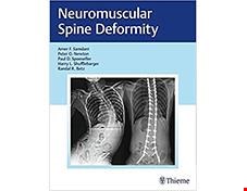 کتاب Neuromuscular Spine Deformity 1st Edition2018 